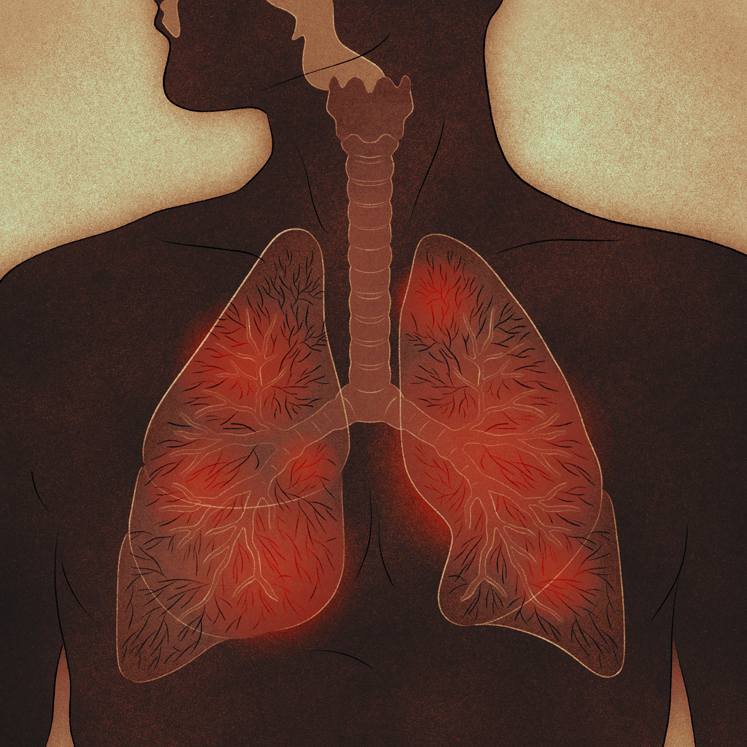 A diagram of a person in which we can see their lungs, which have a red glow.